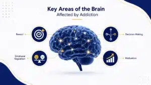 Infographic showing key areas of the brain affected by addiction, including reward, motivation, decision-making, and emotional regulation.